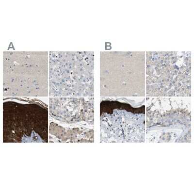 Immunohistochemistry-Paraffin: Serpin B5/Maspin Antibody [NBP1-87778]