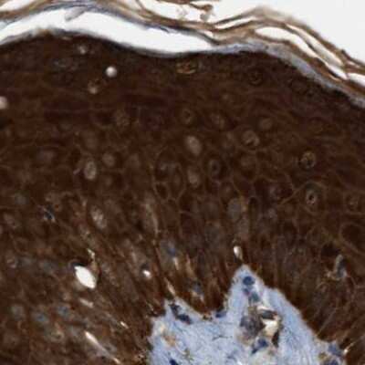 Immunohistochemistry-Paraffin: Serpin B5/Maspin Antibody [NBP1-87778]