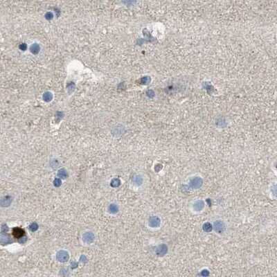 Immunohistochemistry-Paraffin: Serpin B5/Maspin Antibody [NBP1-87778]