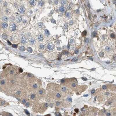 Immunohistochemistry-Paraffin: Serpin B5/Maspin Antibody [NBP1-87778]