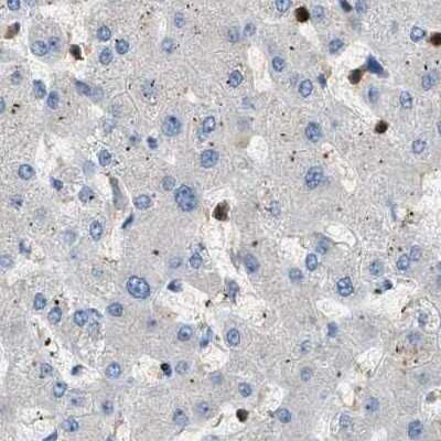 Immunohistochemistry-Paraffin: Serpin B5/Maspin Antibody [NBP1-87778]