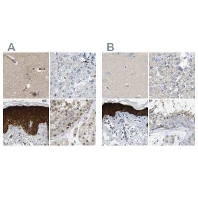 Immunohistochemistry-Paraffin: Serpin B5/Maspin Antibody [NBP1-87779]