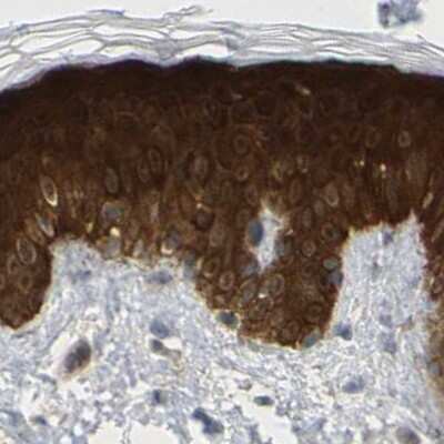Immunohistochemistry-Paraffin: Serpin B5/Maspin Antibody [NBP1-87779]