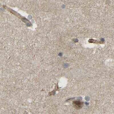 Immunohistochemistry-Paraffin: Serpin B5/Maspin Antibody [NBP1-87779]