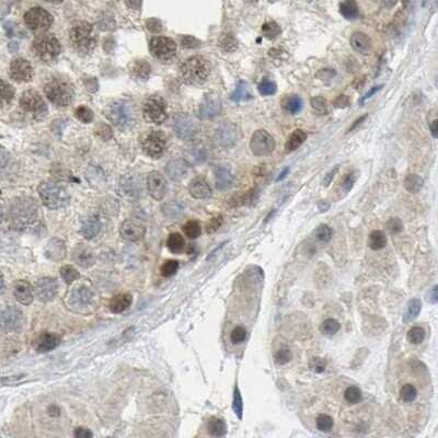 Immunohistochemistry-Paraffin: Serpin B5/Maspin Antibody [NBP1-87779]