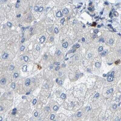 Immunohistochemistry-Paraffin: Serpin B5/Maspin Antibody [NBP1-87779]
