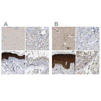 Immunohistochemistry-Paraffin: Serpin B5/Maspin Antibody [NBP1-87780]