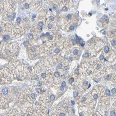 Immunohistochemistry-Paraffin: Serpin B5/Maspin Antibody [NBP1-87780]