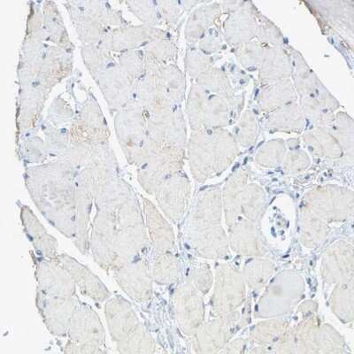 Immunohistochemistry-Paraffin: Serpin B5/Maspin Antibody [NBP1-87780]