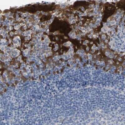 Immunohistochemistry-Paraffin: Serpin B5/Maspin Antibody [NBP1-87780]