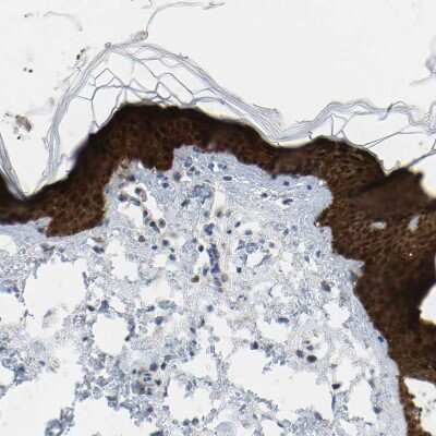 Immunohistochemistry-Paraffin: Serpin B5/Maspin Antibody [NBP1-87780]
