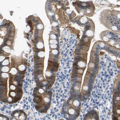 Immunohistochemistry-Paraffin: Serpin B5/Maspin Antibody [NBP1-87780]