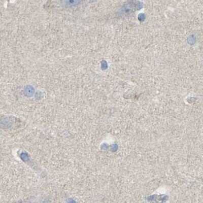 Immunohistochemistry-Paraffin: Serpin B5/Maspin Antibody [NBP1-87780]
