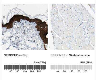 Immunohistochemistry-Paraffin: Serpin B5/Maspin Antibody [NBP1-87780]