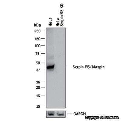 Knockdown Validated: Serpin B5/Maspin Antibody - BSA Free [NB110-97377]