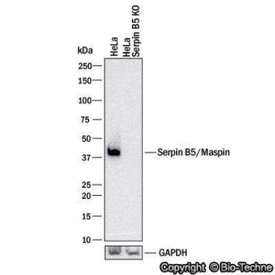 Knockdown Validated: Serpin B5/Maspin Antibody [NBP1-87778]