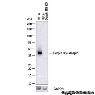 Knockdown Validated: Serpin B5/Maspin Antibody [NBP1-87779]
