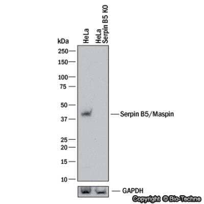 Knockdown Validated: Serpin B5/Maspin Antibody [NBP1-87780]