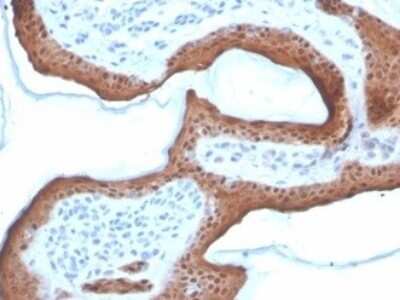 Immunohistochemistry-Paraffin: Serpin B5/Maspin Antibody (SERPINB5/4972) [NBP3-13732]