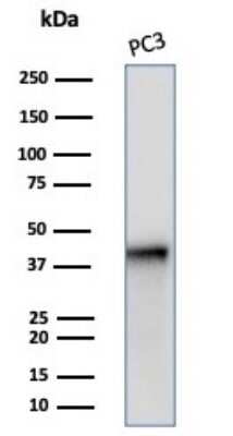 Western Blot: Serpin B5/Maspin Antibody (SERPINB5/4972) [NBP3-13732]