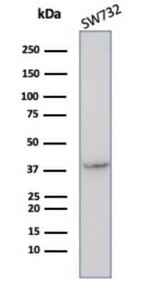 Western Blot: Serpin B5/Maspin Antibody (SERPINB5/4972) [NBP3-13732]