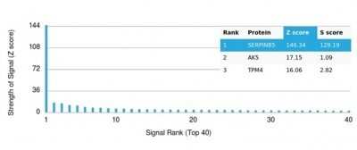 Protein Array: Serpin B5/Maspin Antibody (SERPINB5/4975) - Azide and BSA Free [NBP3-14136]