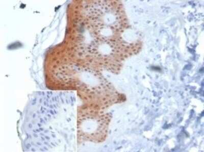 Immunohistochemistry-Paraffin: Serpin B5/Maspin Antibody (SERPINB5/4975) [NBP3-13733]