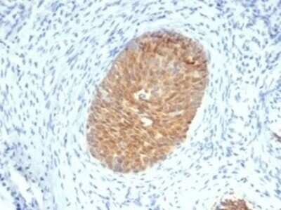 Immunohistochemistry-Paraffin: Serpin B5/Maspin Antibody (SERPINB5/4975) [NBP3-13733]