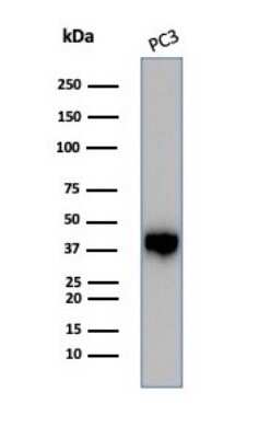 Western Blot: Serpin B5/Maspin Antibody (SERPINB5/4975) [NBP3-13733]