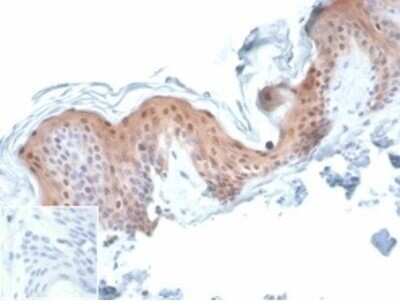 Immunohistochemistry-Paraffin: Serpin B5/Maspin Antibody (SERPINB5/4977) [NBP3-13734]