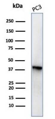 Western Blot: Serpin B5/Maspin Antibody (SERPINB5/4977) [NBP3-13734]