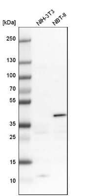 Western Blot: Serpin B5/Maspin Antibody [NBP1-87778]