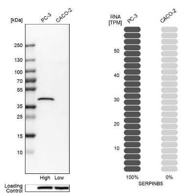 Western Blot: Serpin B5/Maspin Antibody [NBP1-87778]