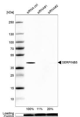 Western Blot: Serpin B5/Maspin Antibody [NBP1-87778]