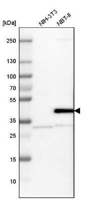 Western Blot: Serpin B5/Maspin Antibody [NBP1-87779]