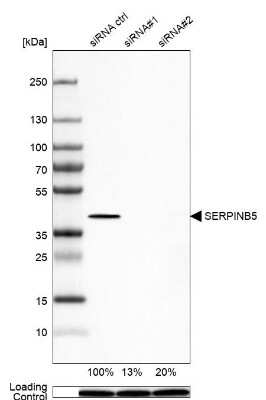 Western Blot: Serpin B5/Maspin Antibody [NBP1-87779]