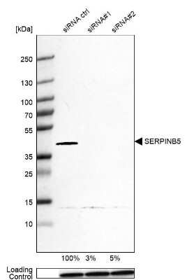 Western Blot: Serpin B5/Maspin Antibody [NBP1-87780]