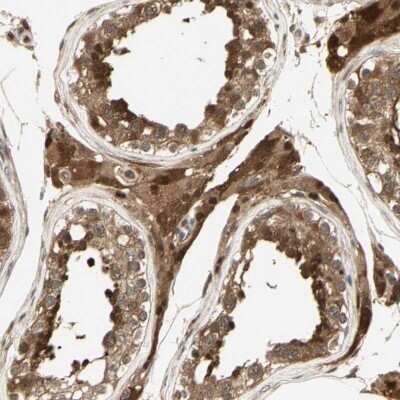 Immunohistochemistry-Paraffin: Serpin B6 Antibody [NBP1-86642]