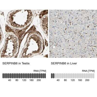 Immunohistochemistry-Paraffin: Serpin B6 Antibody [NBP1-86642]