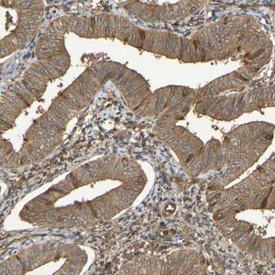 Immunohistochemistry-Paraffin: Serpin B6 Antibody [NBP1-86643]
