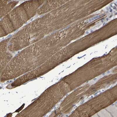 Immunohistochemistry-Paraffin: Serpin B6 Antibody [NBP1-86643]