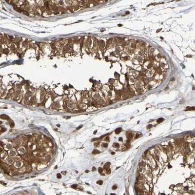 Immunohistochemistry-Paraffin: Serpin B6 Antibody [NBP1-86643]