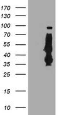 Western Blot: Serpin B6 Antibody (OTI1C5)Azide and BSA Free [NBP2-74111]