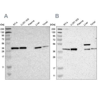 Western Blot: Serpin B6 Antibody [NBP1-86642]