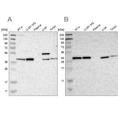 Western Blot: Serpin B6 Antibody [NBP1-86643]