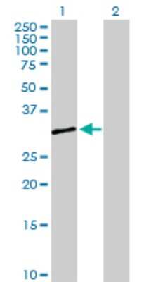 Western Blot: Serpin B8/Proteinase Inhibitor 8 Antibody [H00005271-D01P]