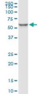 Western Blot: Serpin C1/Antithrombin-III Antibody (2B12) [H00000462-M02]