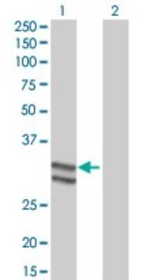 Western Blot: Serpin C1/Antithrombin-III Antibody (2B12) [H00000462-M02]