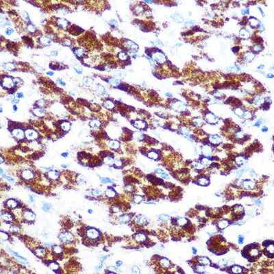 Immunohistochemistry-Paraffin: Serpin C1/Antithrombin-III Antibody (2X2V4) [NBP3-15363]