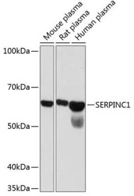 Western Blot: Serpin C1/Antithrombin-III Antibody (2X2V4) [NBP3-15363]